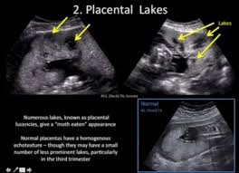 Pin By Heather Kennedy On Radiologia Geral Ultrasound Sonography Obstetric Ultrasound Ultrasound