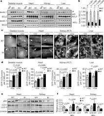 Beth levine and prince hopeful. Disruption Of The Beclin 1 Bcl2 Autophagy Regulatory Complex Promotes Longevity In Mice Nature
