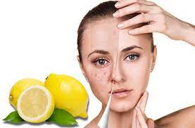 Cara menghilangkan jerawat secara alami juga bisa anda lakukan dengan menggunakan yoghurt. Cara Menghilangkan Jerawat Dengan Lemon Efektif Hanya Dalam 3 Hari