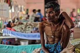 With increased understanding of tb, public health initiatives, treatment methods like isolation of patients (quarantine). Back To The Future Rethinking Global Control Of Tuberculosis Science Translational Medicine