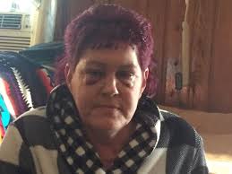 Fundraiser for Lori Skelly by Carly Botsford : Lori Skelly's Road to  Recovery