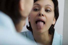 Image result for brown tongue symptoms