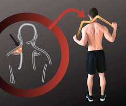 Der obere rücken ist unter anderem aus trapezmuskel, kleinem und großen rundmuskel und dem rückwärtigen teil des deltamuskels aufgebaut. Trapezmuskel Triggerpunkt Bereich Nacken Und Kopf