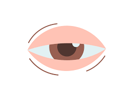 Of course, the swollen, sensitive eyes you wake up with may be due to a lack of sleep rather than to external irritants. Swelling Of One Eyelid Symptoms Causes Common Questions Buoy