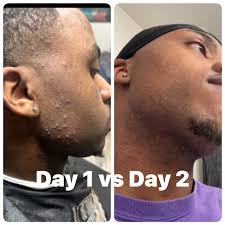 Y'all see the difference, right? 🔥 Smooth, hydrated, confidence-boosting  skin is just one cleanse away! 💧💪🏾 Pre-order your Pore l Trait Cleanser  and Rejuvenating Moisturizing Oil TODAY and start your glow-up journey.