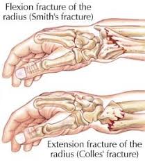 Nbcot Study Cards Flashcards Hand Therapy Physical Therapy Occupational Therapy