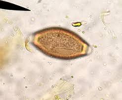 Image result for Whipworm