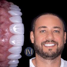 Luiz Marotti (@drluizmarotti) · Instagram 照片和视频