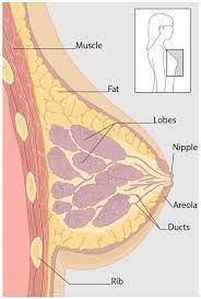 Breast cancer (bc) is one of the most common cancers among women in the world today. What Is Breast Cancer Cdc