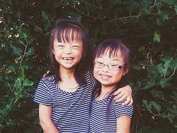 China Down Syndrome Initiative Cradle Of Hope Adoptions