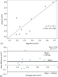 Any other type of function, with one or more parameters (e.g. Regression Analysis An Overview Sciencedirect Topics