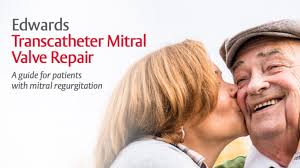 The PASCAL Precision system