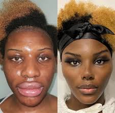 Cosmetic Surgery and Public Figures' Appearances