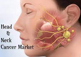 A lump in the neck —cancers that begin in the head or neck usually spread to lymph nodes in the neck before they spread elsewhere. Head And Neck Cancer Market Symptoms And Signs Analysis 2026