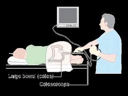However, a patient will not be fully recovered from the anesthesia until up to 48 hours after the procedure. Wirral Surgeon Procedures Colonoscopy