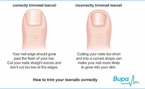Hangnails What Are They And How To Prevent Them Palm Desert Palm Springs Contour Dermatology Ingrown Toe Nail Toe Nails Nail Remedies