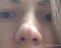 Otzyv O Kniga Aerobika Dlya Kozhi I Myshc Lica Kerol Maddzhio Kak Umenshit Nos Esli On Bolshoj Krupnyj Massivnyj Kartoshkoj Iskrivlennyj I S Razdvoennym Konchikom