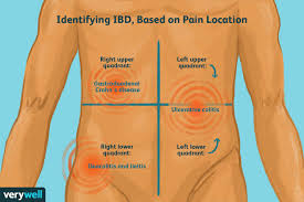 The human abdomen is divided into quadrants and regions by anatomists and physicians for the purposes of study, diagnosis, and treatment. What Inflammatory Bowel Disease Pain Feels Like