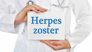 Die gürtelrose, medizinisch korrekt herpes zoster genannt, betrifft jährlich rund 400.000 deutsche, der großteil von ihnen ist über 50 jahre alt. Uber 3 300 Falle Von Gurtelrose Herpes Zoster In Nebenwirkungs Datenbank