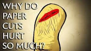 Why Do Paper Cuts Hurt So Much? - Instant Egghead #25 - Youtube