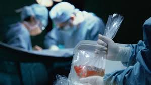 Los casos de lesión cerebral anóxica moderada tienen un mejor resultado, pero la recuperación aún puede tardar meses o años. Y Si La Muerte Cerebral Fuera Reversible