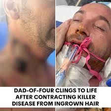 At first, Shawn Dell thought he had a bad case of food poisoning. 📌MORE:  7news.link/44J6UPb