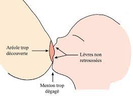 Comment Avoir Une Bonne Prise Du Sein Et Réussir Vos Tétées?