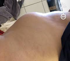 Nehme seit 6 monaten belara. Bin Ich Schwanger Oder Ist Das Ein Normaler Bauch Umfrage Sexualitat Schwangerschaft
