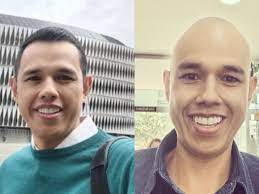 Diego Guauque mostró su nuevo look: se rapó por las quimioterapias