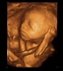 Consultas médicas y ecografía gestacional. Ecografia 3d 4d 22 Semanas De Embarazo Club De Bebitos Febrero 2017 Babycenter