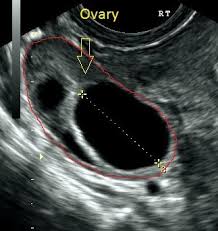 The abdominal, the pelvic/gynaecology and the urinary ultrasound scan. Pelvic Ultrasound Scans For Women In London Ultrasound Services