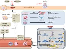 Image result for Medications in COPD Management