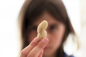 Plants (including fruits and vegetables) are grouped into various families, which share similar proteins. Peanut Allergy Levels Allergy To Peanut Oil The Peanut Institute