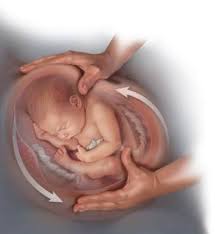 Pastinya sudah menjadi impian setiap pasangan suami isteri untuk memiliki cahayamata sebagai pelengkap sebuah keluarga. Ini Moms Caranya Mengatasi Bayi Sungsang Usia 8 Bulan