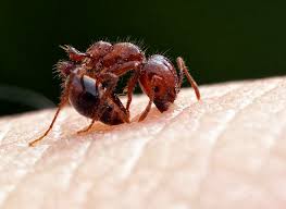 Image result for Fire Ant Sting