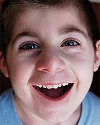 RTS Patient Inspires Those Around Him