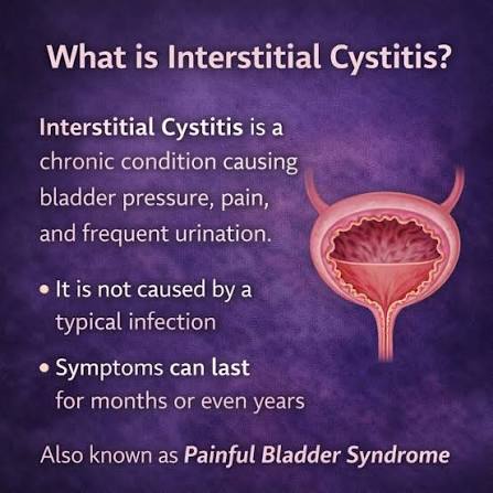 Interstitial Cystitis (IC) &ndash; Chronic Bladder Pain Matters Experiencing  ongoing bladder discomfort or pressure? It could be Interstitial Cystitis  (IC), a condition that affects bladder health and quality of life. Common  Symptoms: &bull;