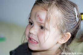 Iata ce trebuie sa stie o rice parinte despre loviturile la cap ale copilului. 10 Situatii In Care Trebuie Sunat De Urgenta Medicul Pediatru Desprecopii Com