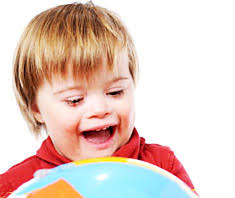 Trisomie 21 Down Syndrom Ein Chromosom Zuviel Gesund Co At