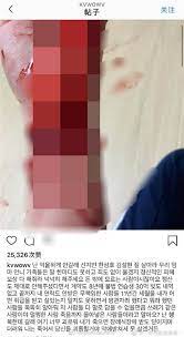 Join facebook to connect with 珉娥 and others you may know. Aoaæ¬Šç‰å¨¥å†poè¡€æ·‹æ·‹å‰²è…•ç…§ç•™éºæ›¸é»žåé›ªç‚« å¥½å¥½æ´»è'—å§ å¨›æ¨‚ ä¸­æ™‚æ–°èžç¶²