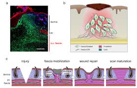 Furnishing Wound Repair by the Subcutaneous Fascia