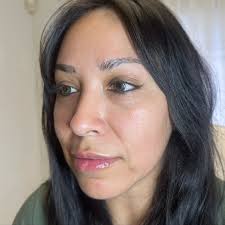 Andrea Gower (@andrea.injects) • Instagram photos and videos