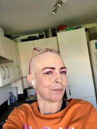 Hair loss affects 1 in 10 women before the menopause