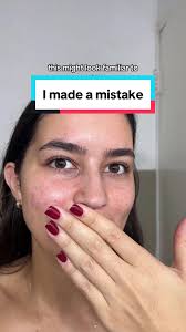 Do i regret it? A little. Was it a satisfying pop at least? Yes. Would i do  it again? 🤐 #acne #relatable #blackhead #skincaremistake #lipacne