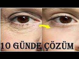 10 Gunde Goz Alti Kirisiklari Giderici Botoks Etkili Dogal Maske Tarifi Guzellik Bakim Youtube Maskeler Guzellik Gozler