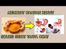 Lalu rebus dengan 500 cc air, rebus sampai airnya tinggal separuhnya. Cara Membuat Ramuan Kunyit Untuk Asam Lambung Youtube