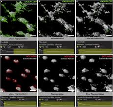 The pain under your right rib cage can be mild or severe, depending on the causes. Quantification Of Microglial Contact And Engulfment Of Oligodendrocyte Progenitor Cells In The Rodent Brain Sciencedirect