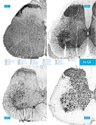 Between this, increased difficulty scaling of delirium via atlas passive, replacing monster with einhar's beasts, and simultaneous fight with 10 bosses, i'm definitely not gonna be in hc this league. Atlas Of The Rat Spinal Cord Sciencedirect