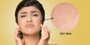 Image result for Dry Skin