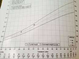 Understanding 50th Centile Growth Chart Netmums